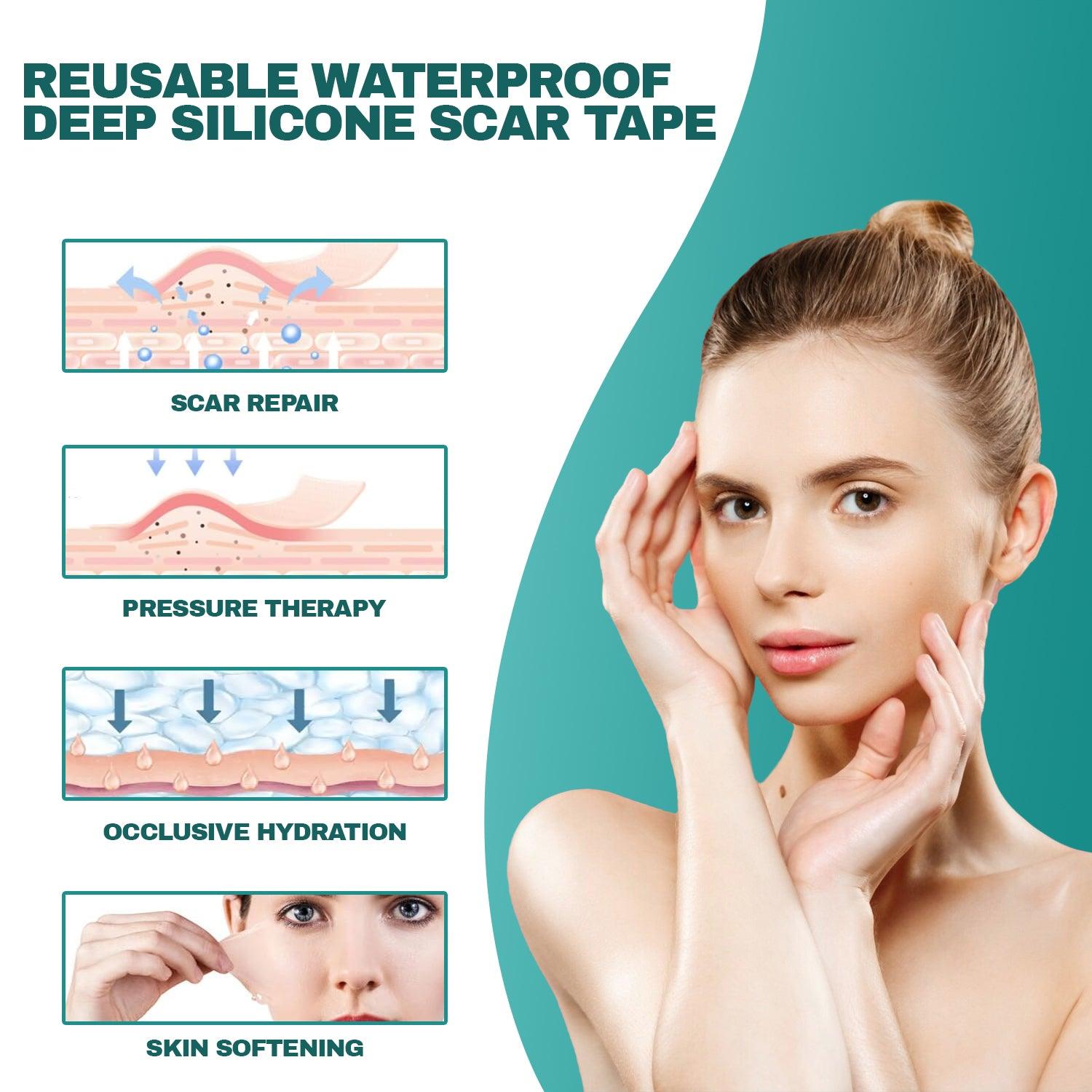 Silicone Scar Sheets - Medical Grade (1.6"x120") Scar Tape Professional Reusable Scar Removal Treatment Health Care - Tophatter Daily Deals