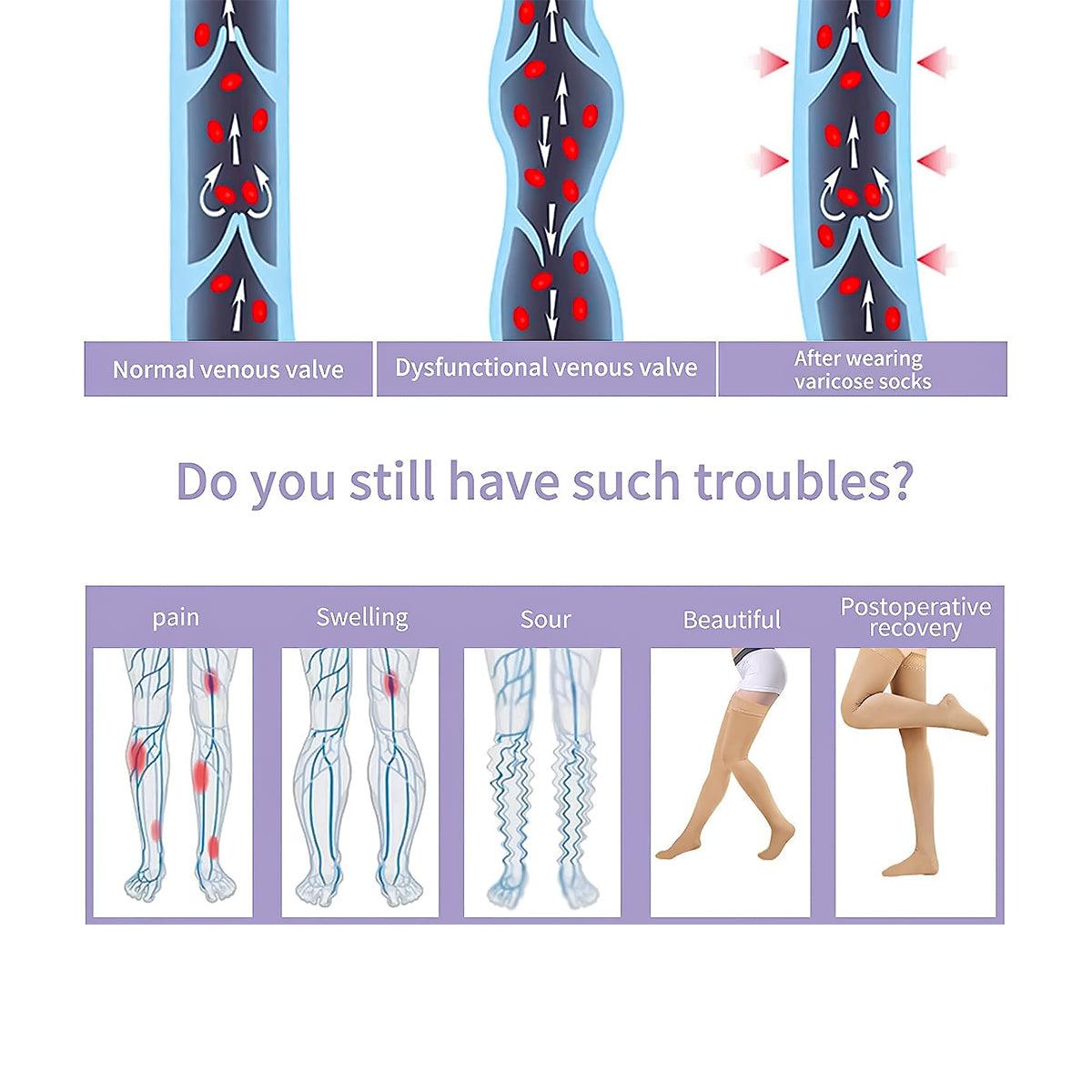 Medical Compression Stockings UK - Support Stockings 20-30 mmHg Graduated Support Socks Relief Calf Men Women Health Care - Tophatter Daily Deals