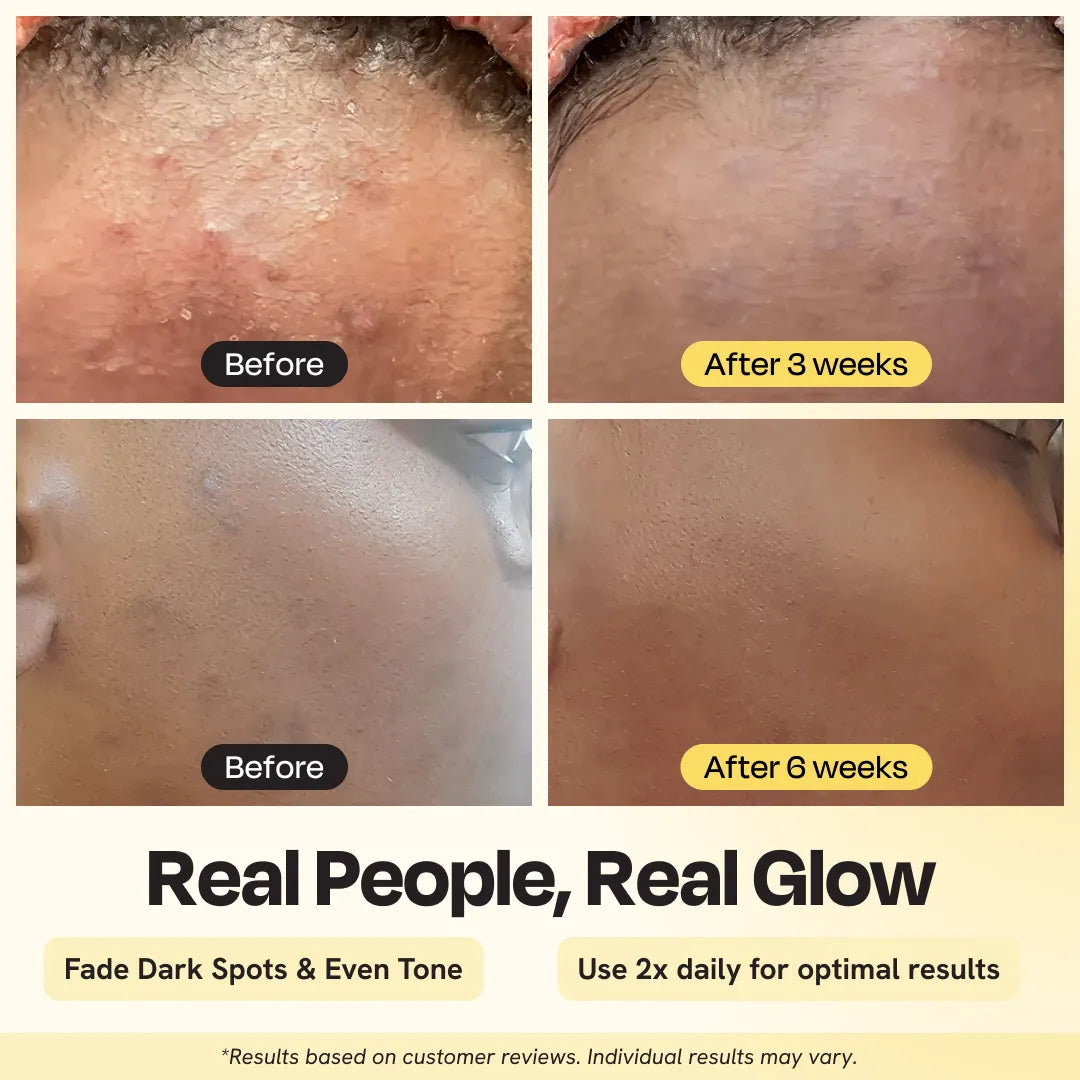 Advanced Brightening Moisturizer Beauty & Personal Care - Tophatter Daily Deals
