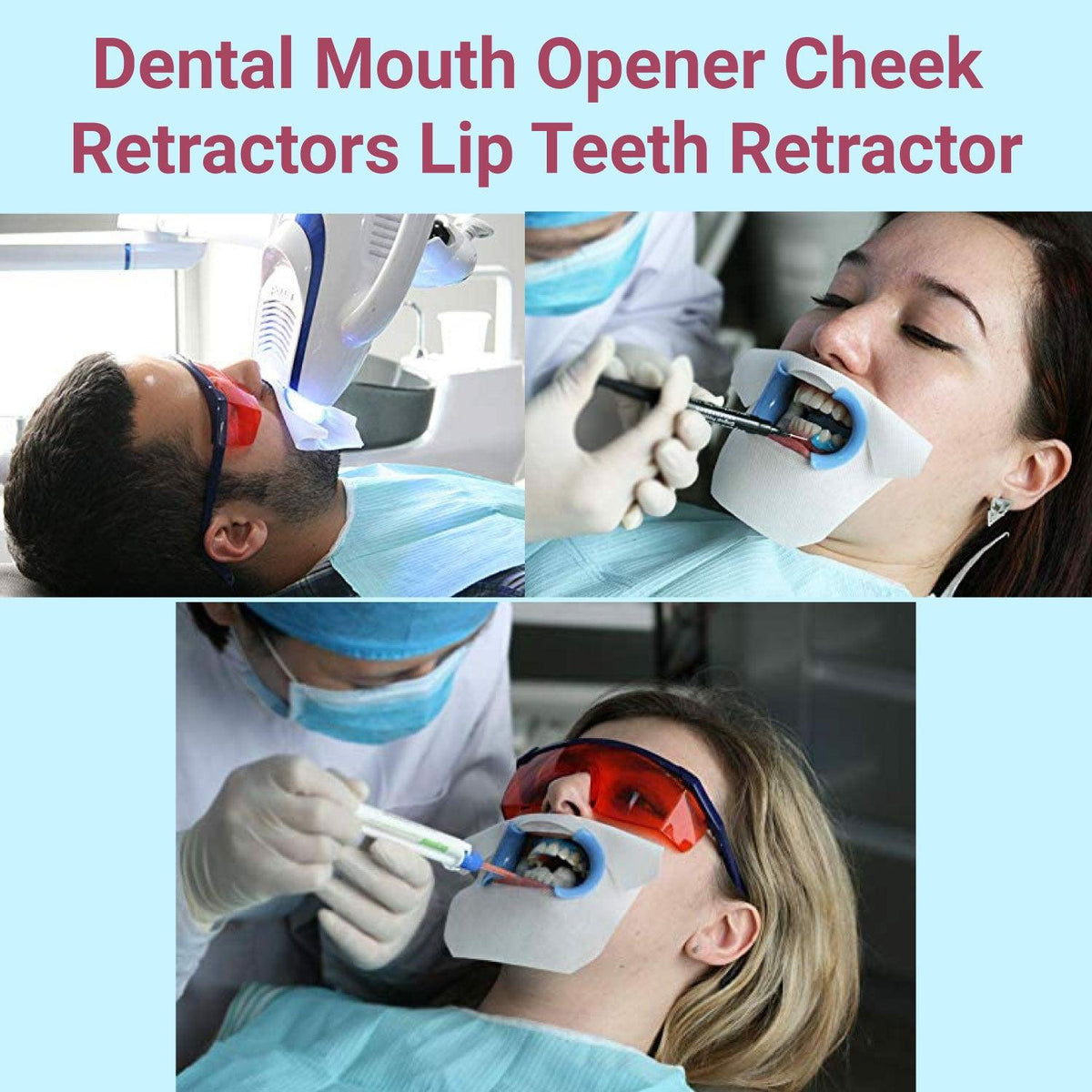 Cheek Retractors Dental - Mouth Opener 10pcs M Shape Blue Cheek Retractor Dental Mouth Opener Orthodontic Mouth Prop Opener Dental Treatment Kit Personal Care - Tophatter Daily Deals
