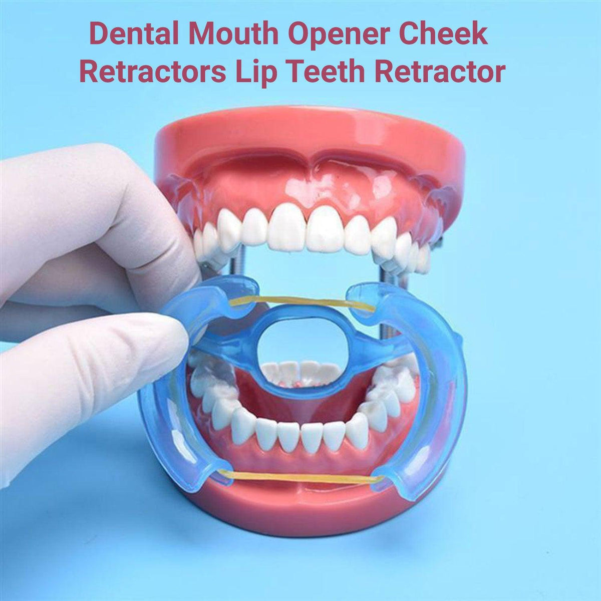 Cheek Retractors Dental - Mouth Opener 10pcs M Shape Blue Cheek Retractor Dental Mouth Opener Orthodontic Mouth Prop Opener Dental Treatment Kit Personal Care - Tophatter Daily Deals