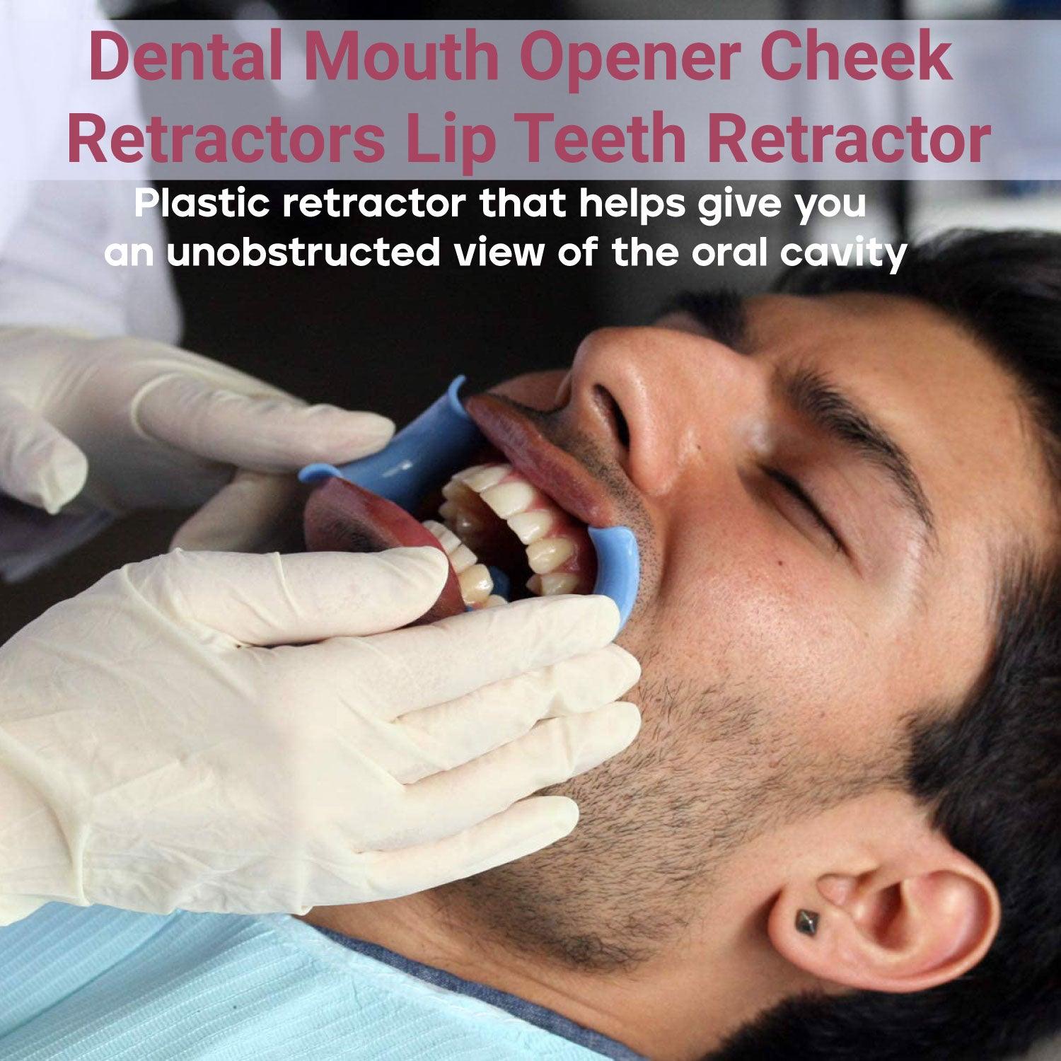 Cheek Retractors Dental - Mouth Opener 10pcs M Shape Blue Cheek Retractor Dental Mouth Opener Orthodontic Mouth Prop Opener Dental Treatment Kit Personal Care - Tophatter Daily Deals