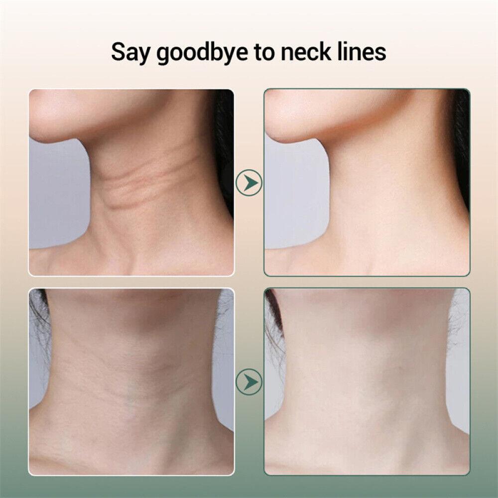 Cream for Wrinkles Neck - V Shaping Massager Electric Slim LIFT Double Chin Removal device Health & Beauty - Tophatter Daily Deals