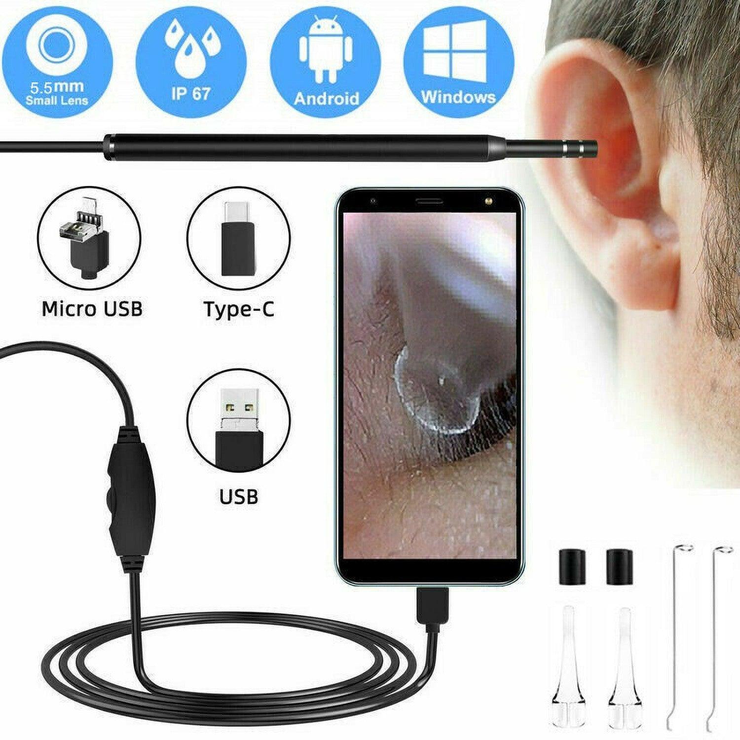 Ear Camera Wax Removal - Wireless WiFi Ear Wax Remover Camera Ear Endoscope Spoon Pick Cleaning Tool Kit New Arrival - Tophatter Daily Deals