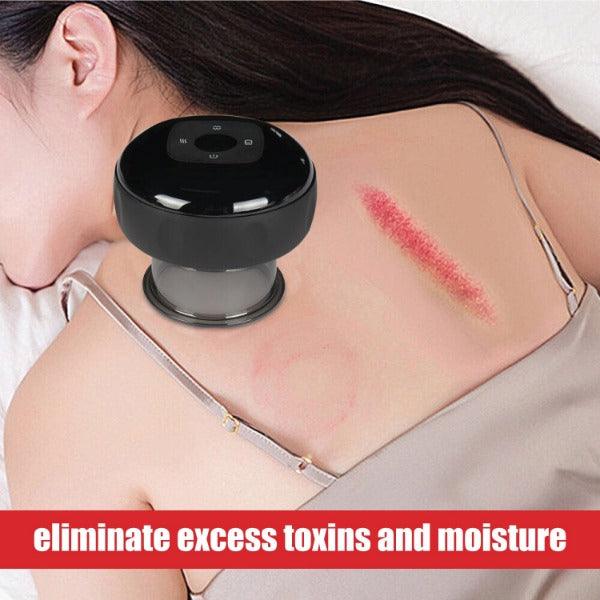 Electric Cupping Machine - Smart Cupping Device Therapy Scraping Tools for Muscle Pain Relief Personal Care - Tophatter Daily Deals