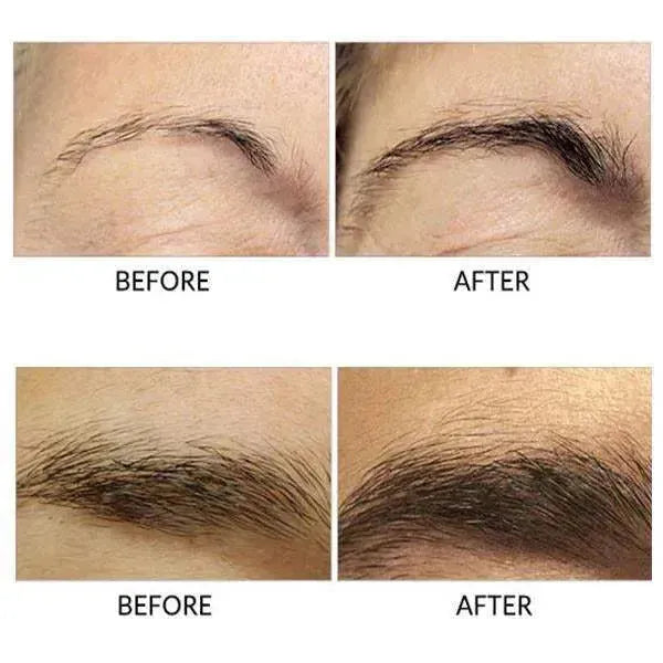 FEG Eyebrows Growth Serum Eyebrow Enhancers - Tophatter Daily Deals