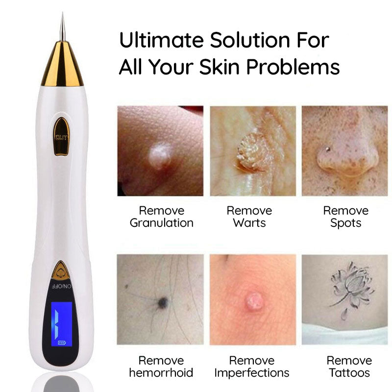 Mole Remover Pen At Home Skin Tag Removal Painless Fast - Tophatter Daily Deals
