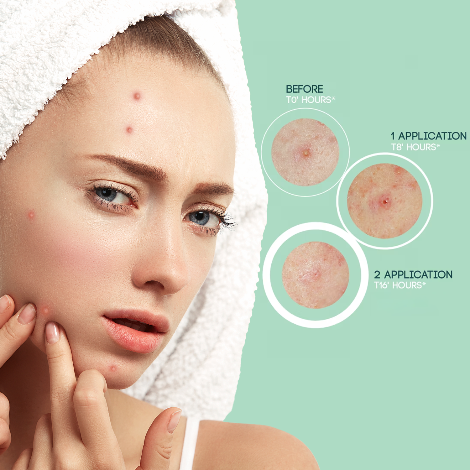 Hydrocolloid Pimple Patches – Dots for Spots Acne Patch | Pack of 24 Korean Skincare Spot Stickers Hydrocolloid pimple patches - Tophatter Daily Deals