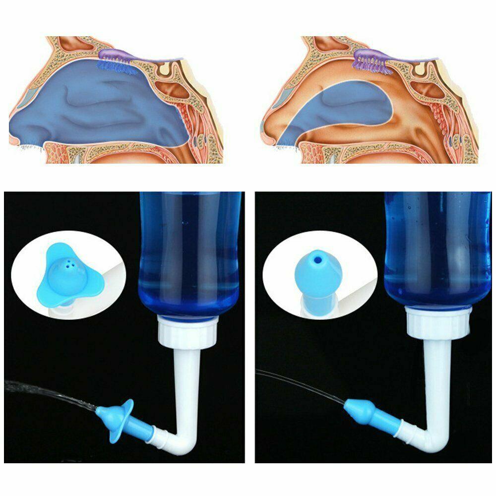 Sinus Rinse Kit - 300/500ML Neti Pot Sinus Rinse Bottle Nose Wash Cleaner Nasal Irrigation Kit UK Personal Care - Tophatter Daily Deals