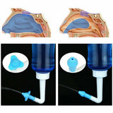 Sinus Rinse Kit - 300/500ML Neti Pot Sinus Rinse Bottle Nose Wash Cleaner Nasal Irrigation Kit UK Personal Care - Tophatter Daily Deals
