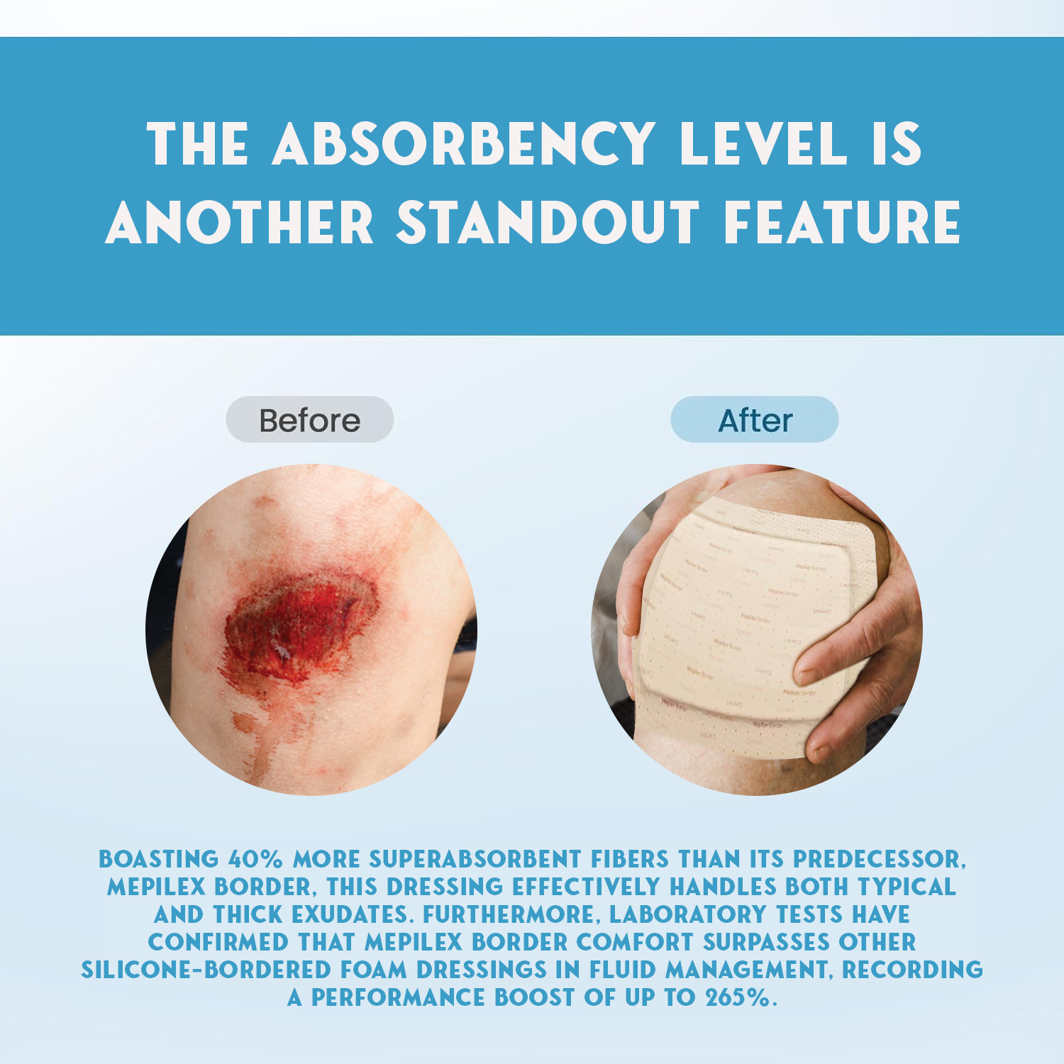 Medical Dressing Pads – Soft Absorbent Pads for Burns, Cuts, and Post-Surgery Healing Health Care - Tophatter Daily Deals