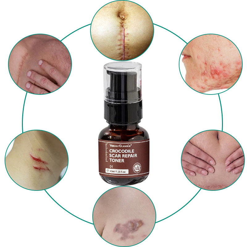 Scar Repair Toner Oil Free Vegan Skin Scar Reducer - Tophatter Daily Deals