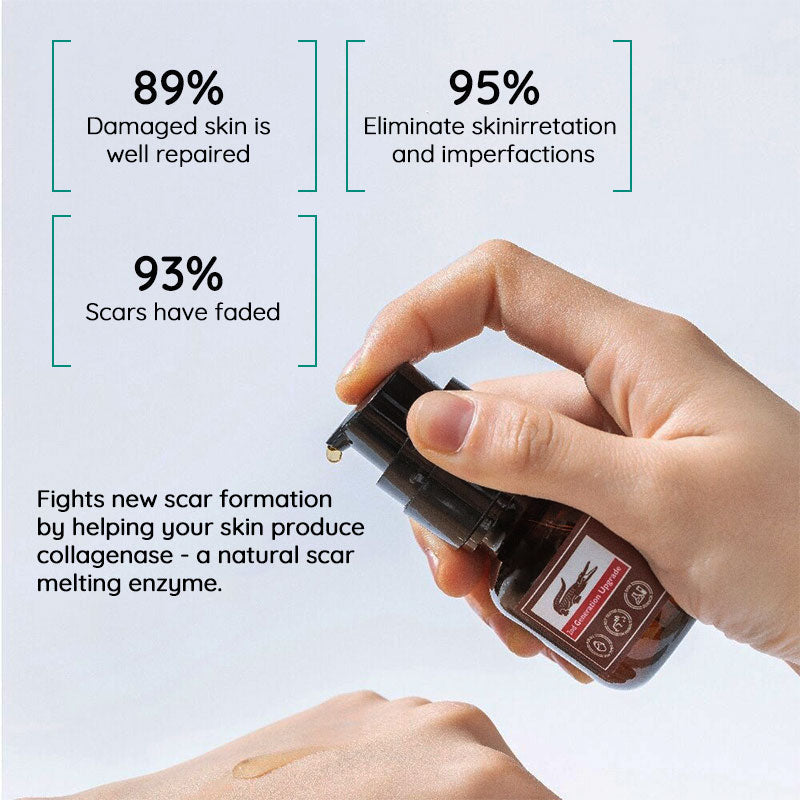 Scar Repair Toner Oil Free Vegan Skin Scar Reducer - Tophatter Daily Deals