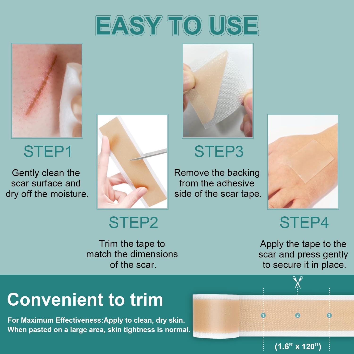 Silicone Scar Sheets - Medical Grade (1.6