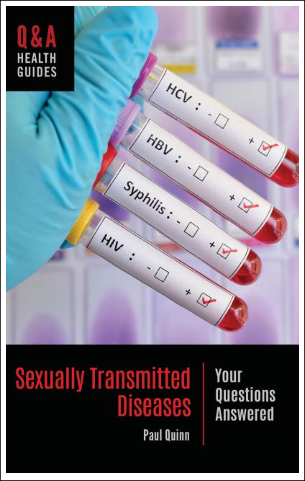 Sexually Transmitted Diseases: Your Questions Answered Books - Tophatter Daily Deals