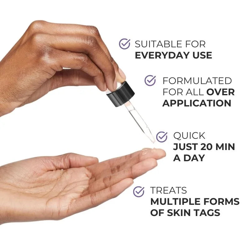 Skin Tag Remover Serum Clear Skin Precision Treatment - Tophatter Daily Deals
