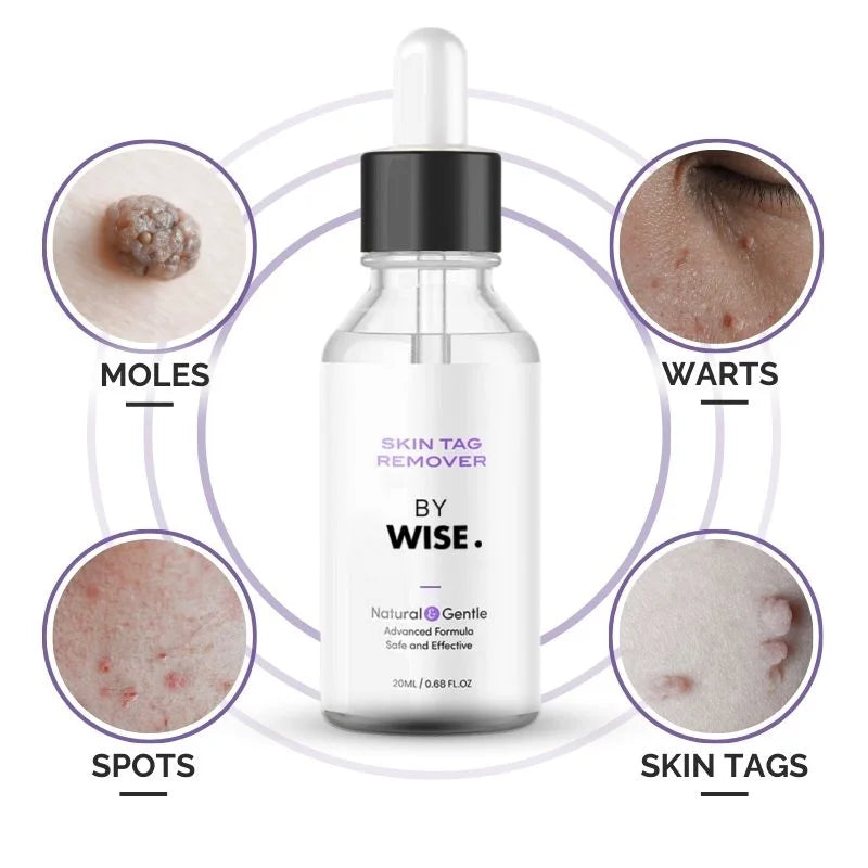 Skin Tag Remover Serum Clear Skin Precision Treatment - Tophatter Daily Deals
