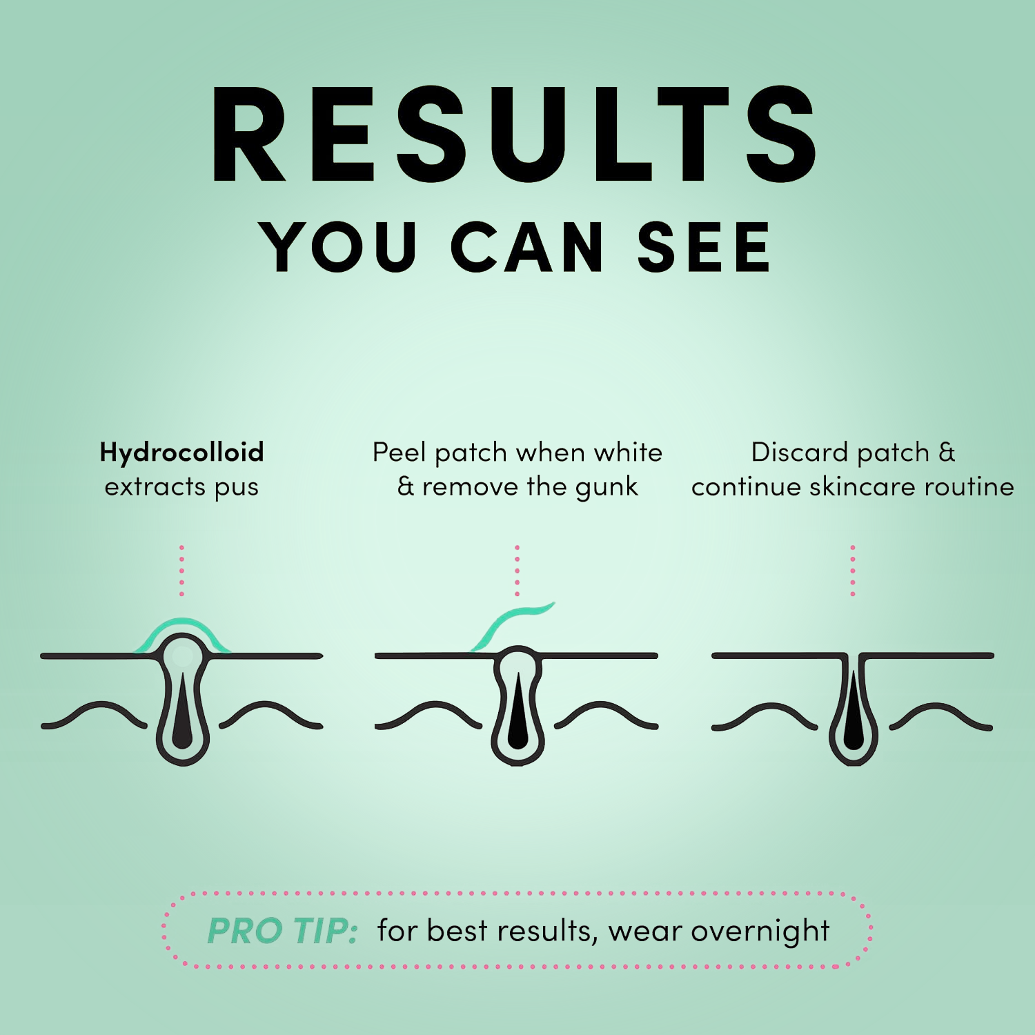 Hydrocolloid Pimple Patches – Dots for Spots Acne Patch | Pack of 24 Korean Skincare Spot Stickers Hydrocolloid pimple patches - Tophatter Daily Deals