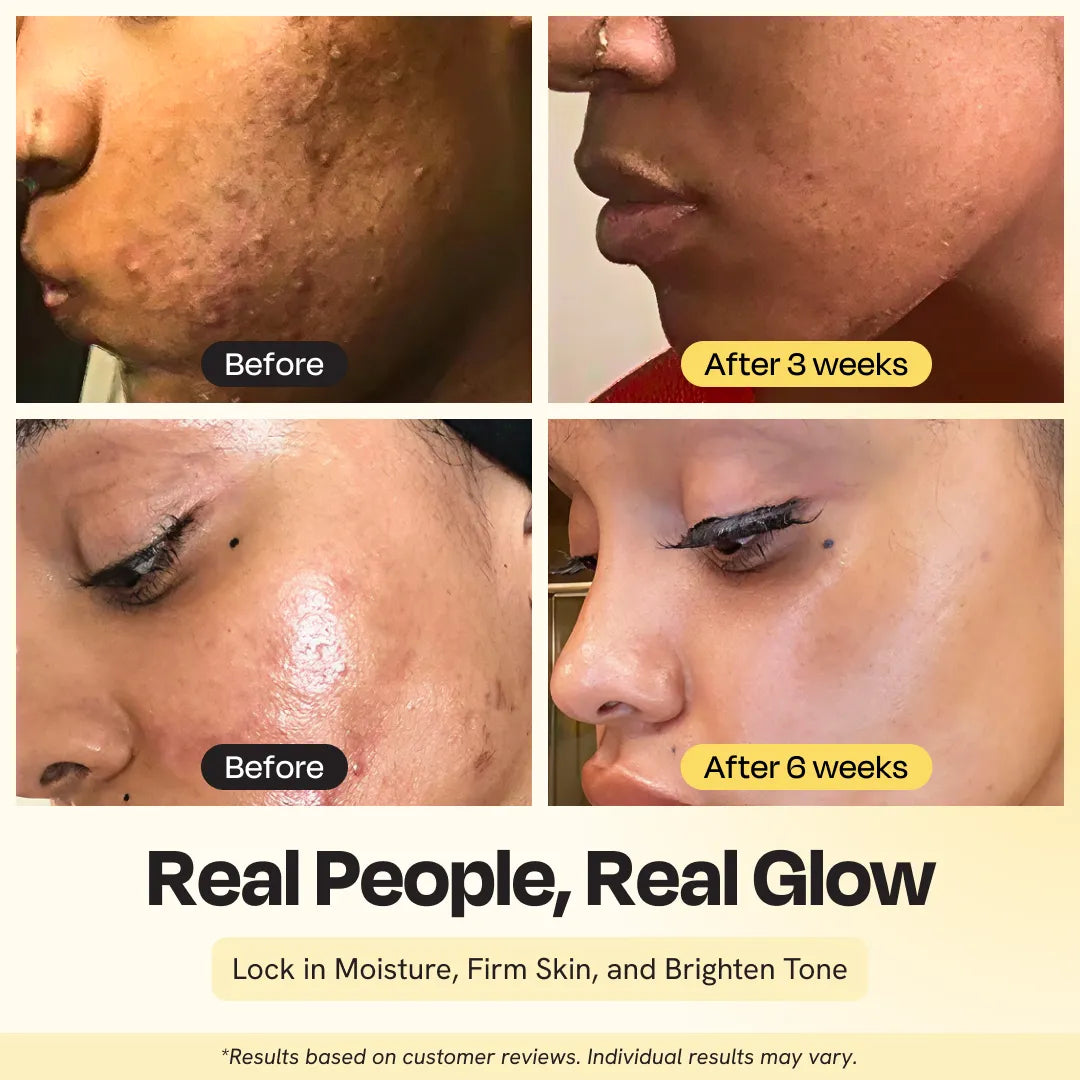 Supernutrient Oil Beauty & Personal Care - Tophatter Daily Deals