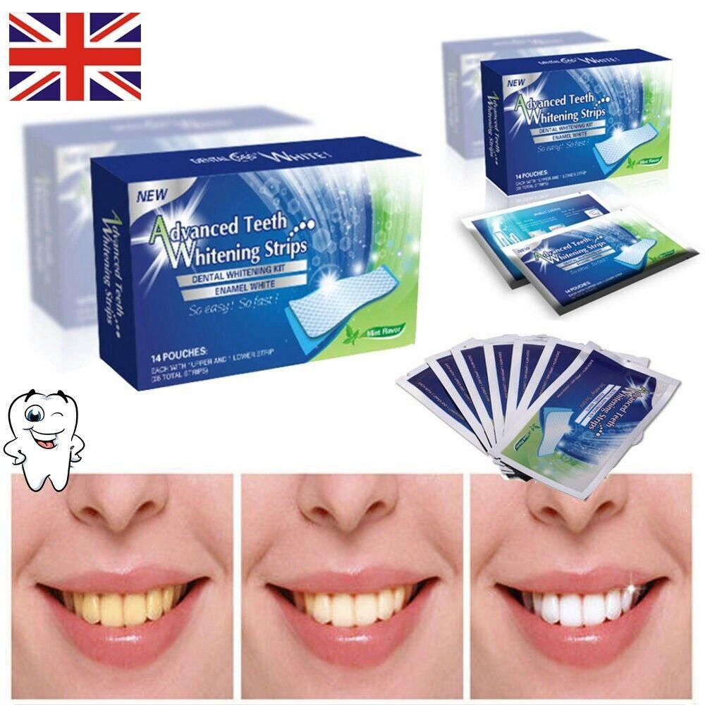 Teeth Whitening Strips - 28 Professional Advanced Teeth Whitening Strips Home Tooth Bleaching UK Non Toxic - Sensitivity Free Health Care - Tophatter Daily Deals