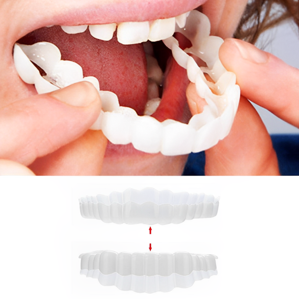 Smile Veneers Upper And Lower Instant Cover For All Day - Tophatter Daily Deals