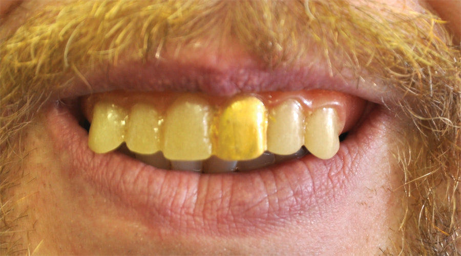Teeth Glow Gold Miner Costume Accessories - Tophatter Daily Deals
