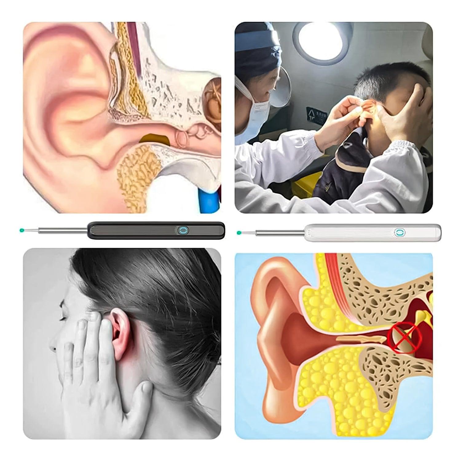 Ear Cleaning Machines - Wi -Fi visible wax elimination spoon Baby Health & Grooming Kits - Tophatter Daily Deals