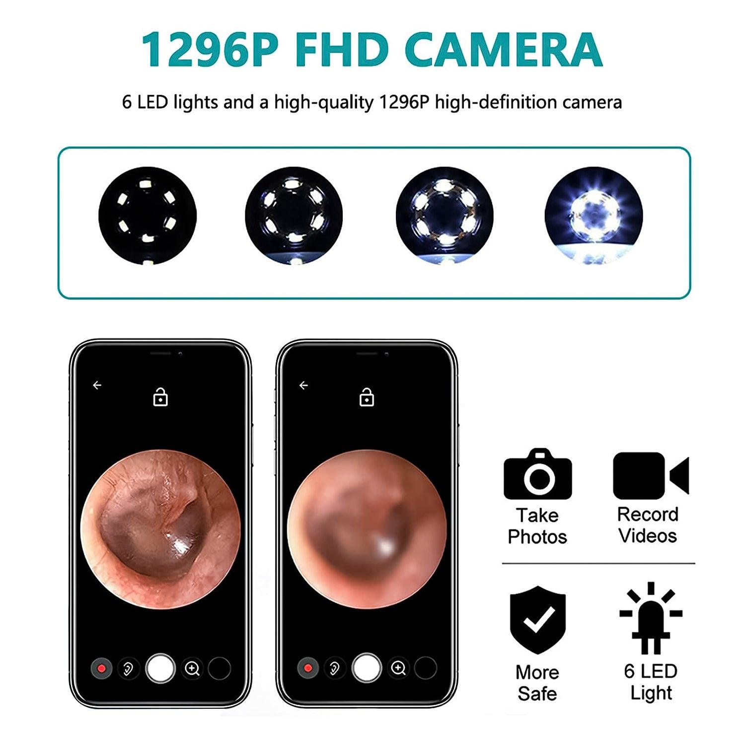 Ear Cleaning Machines - Wi -Fi visible wax elimination spoon Baby Health & Grooming Kits - Tophatter Daily Deals