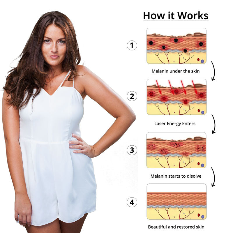Picosecond Laser Pen Tattoo Removal Device Fast Safe - Tophatter Daily Deals