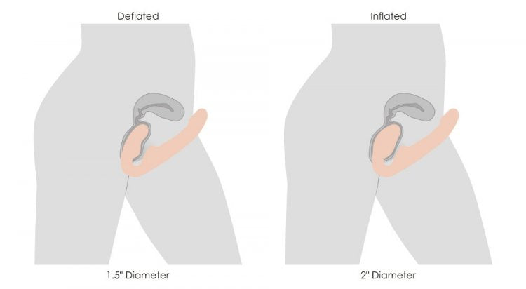 Ergo-Fit Twist: Inflatable & Vibrating Strapless Strap On Dildoes & Dongs - Tophatter Daily Deals