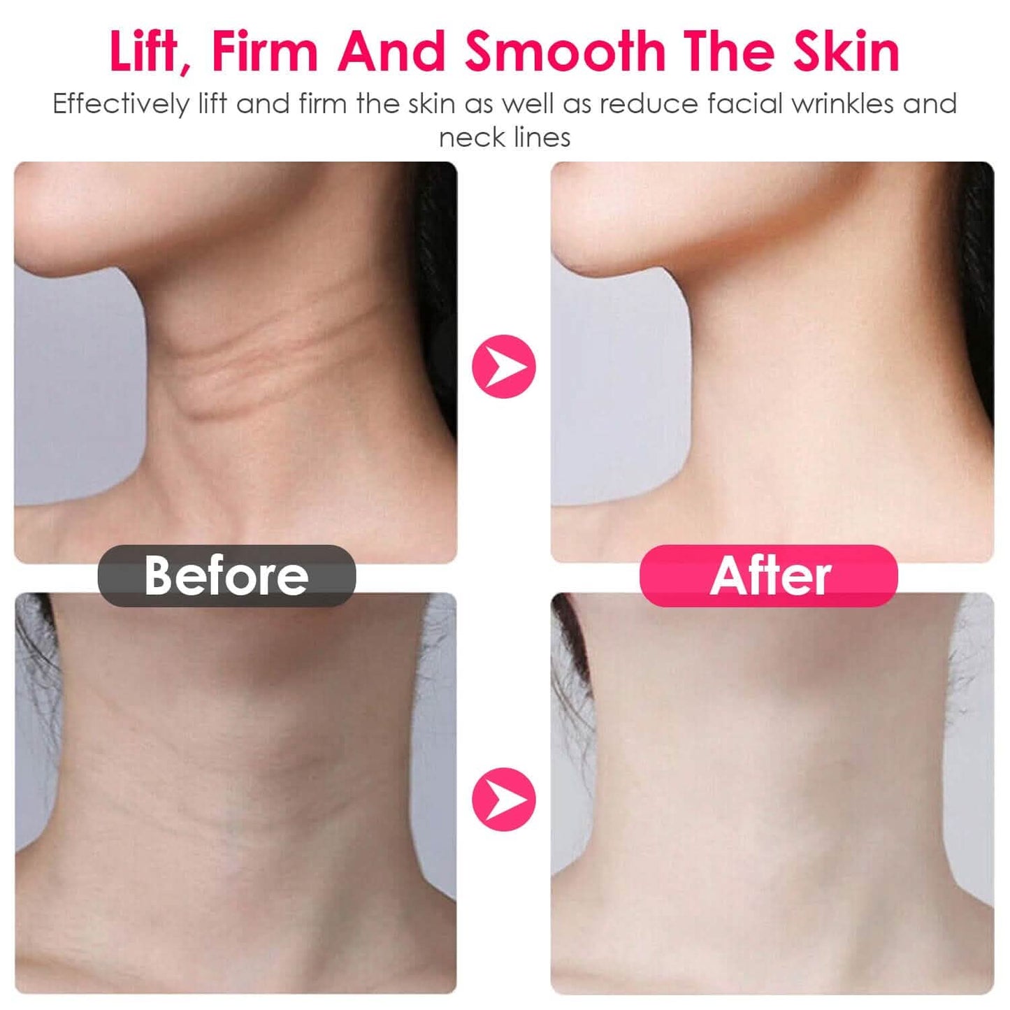 Anti Wrinkles Face Neck Massager Double Chin Reducer Beauty & Personal Care - Tophatter Daily Deals