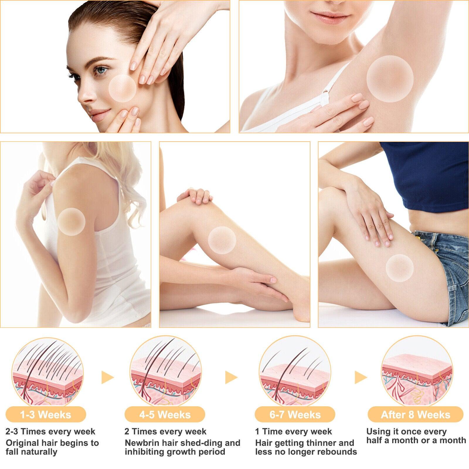 Home Hair Removal Laser - Laser Hair Removal Machine Permanent Painless Epilator Body Facial Personal Care - Tophatter Daily Deals