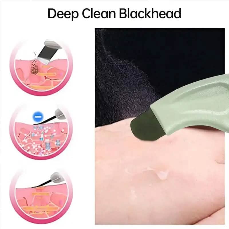 Blackhead Remover Tool Extractor Beauty & Personal Care - Tophatter Daily Deals