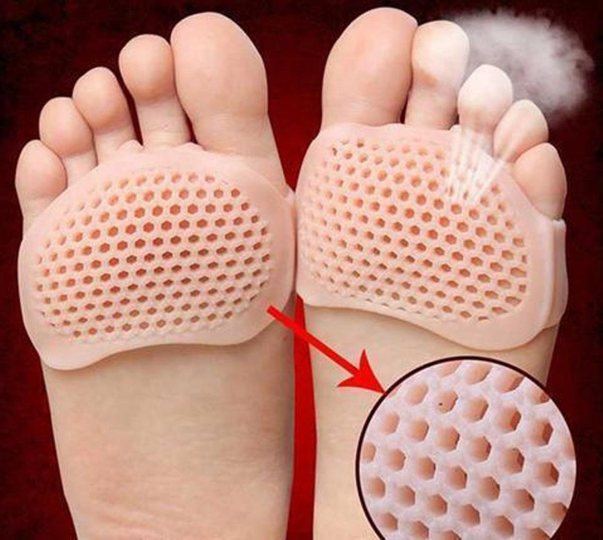 Metatarsal Pads Breathable Gel Forefoot Cushions Set Of 2 - Tophatter Daily Deals