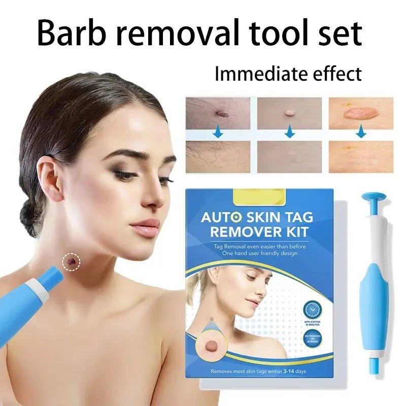 Skin Tag Removal Kit Blue Handheld At Home Fall 2025 - Tophatter Daily Deals