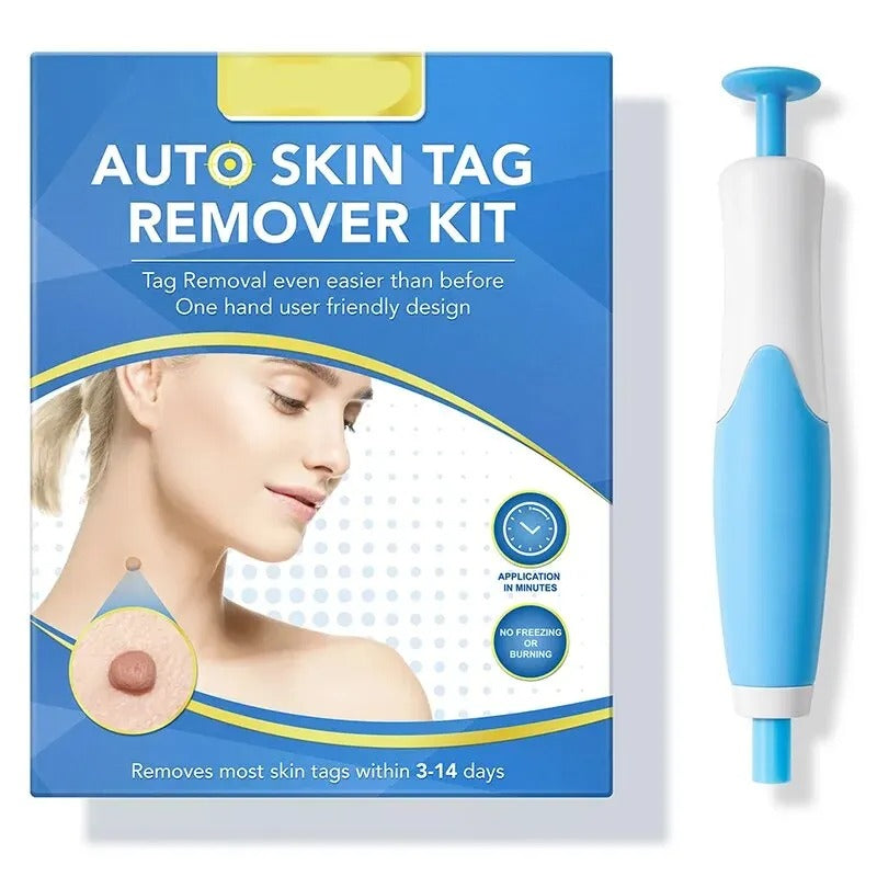 Skin Tag Removal Kit Blue Handheld At Home Fall 2025 - Tophatter Daily Deals