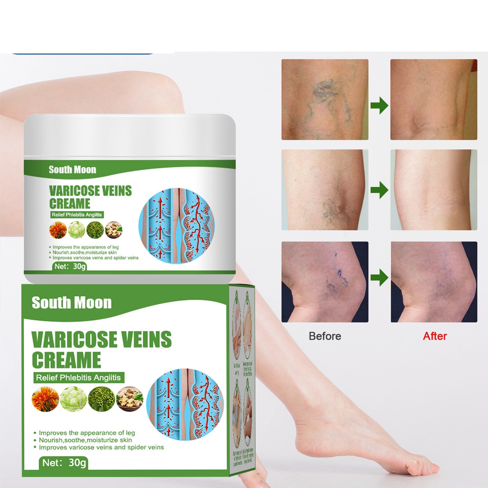 Blue Veins Bulging Pain Relief Leg Massage Cream 0 - Tophatter Daily Deals