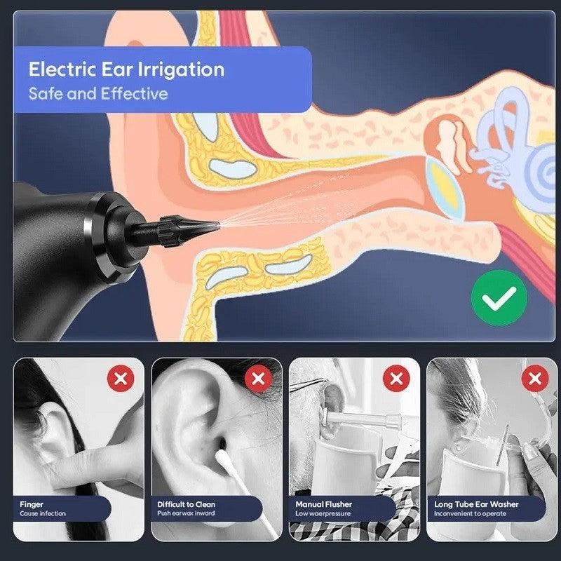Ear Wax Removal Tool - Water Powered Push Ear Cleaner Electric Ear Cleaning Kits Health & Beauty - Tophatter Daily Deals