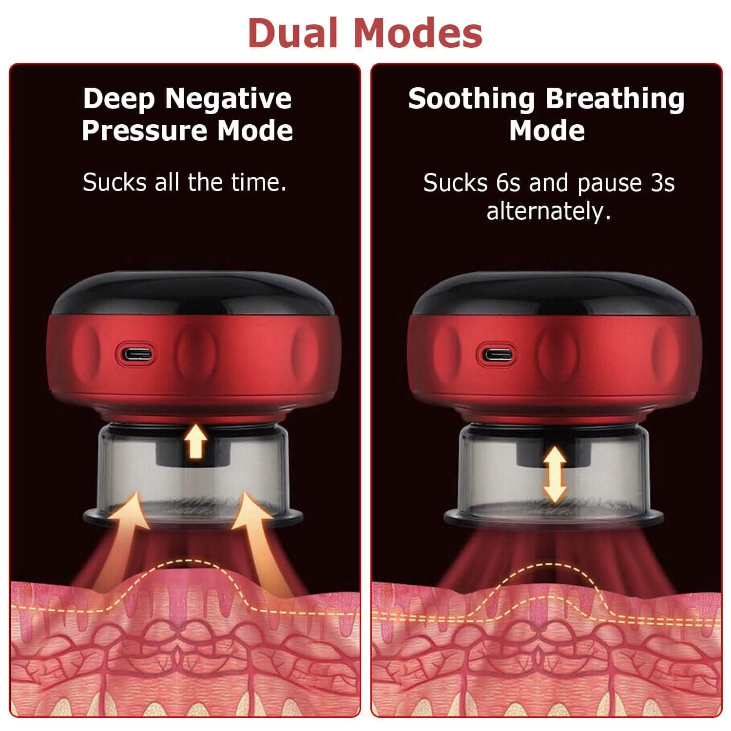 Electric Back Scraping Machine Vacuum Therapy Cupping Device Health & Wellness - Tophatter Daily Deals