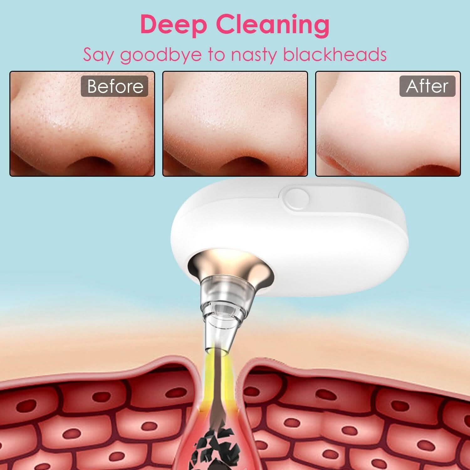 Electric Blackhead Comedone Extractor Tool Facial Pore Cleaner Beauty & Personal Care - Tophatter Daily Deals