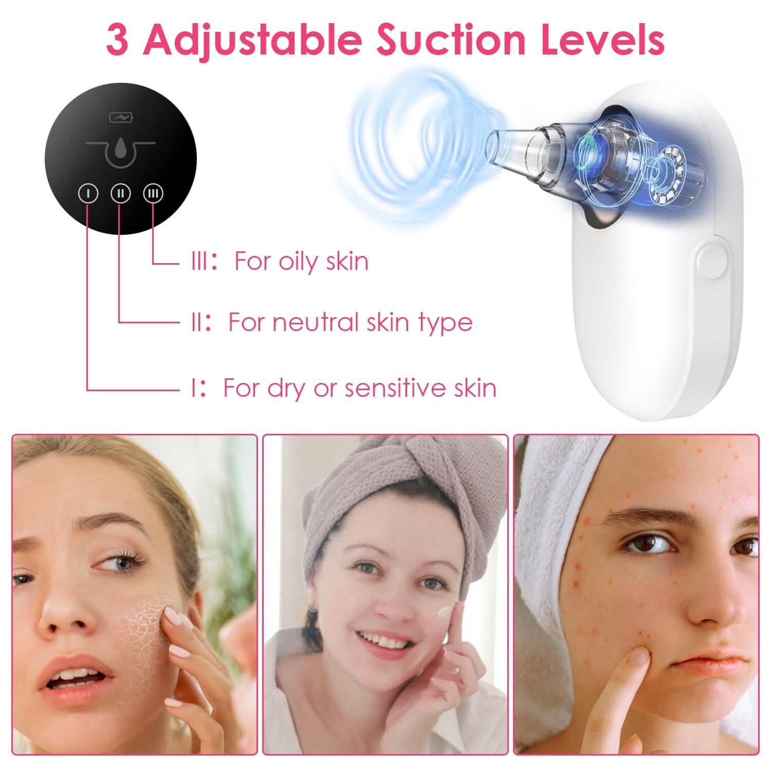 Electric Blackhead Comedone Extractor Tool Facial Pore Cleaner Beauty & Personal Care - Tophatter Daily Deals