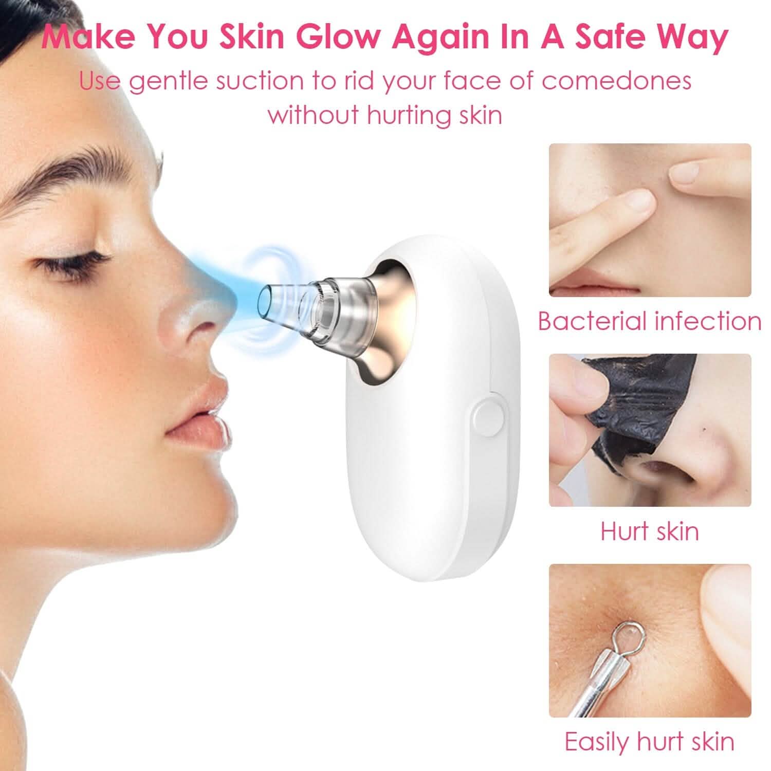 Electric Blackhead Comedone Extractor Tool Facial Pore Cleaner Beauty & Personal Care - Tophatter Daily Deals