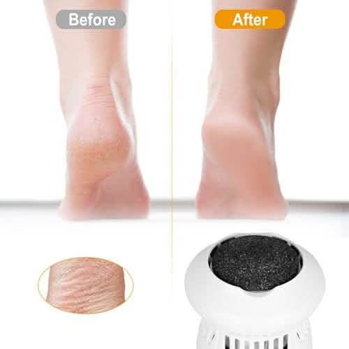 Electric Callus Grinder USB Rechargeable Beauty & Personal Care - Tophatter Daily Deals
