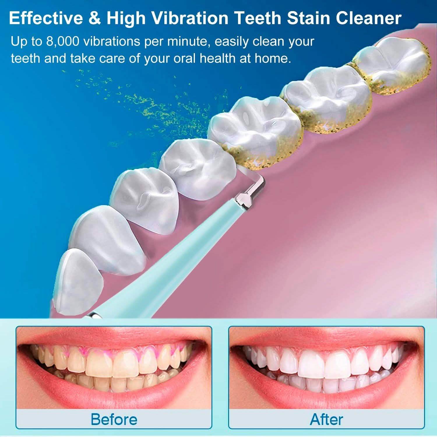 Electric Tartar Remover For Teeth Beauty & Personal Care - Tophatter Daily Deals