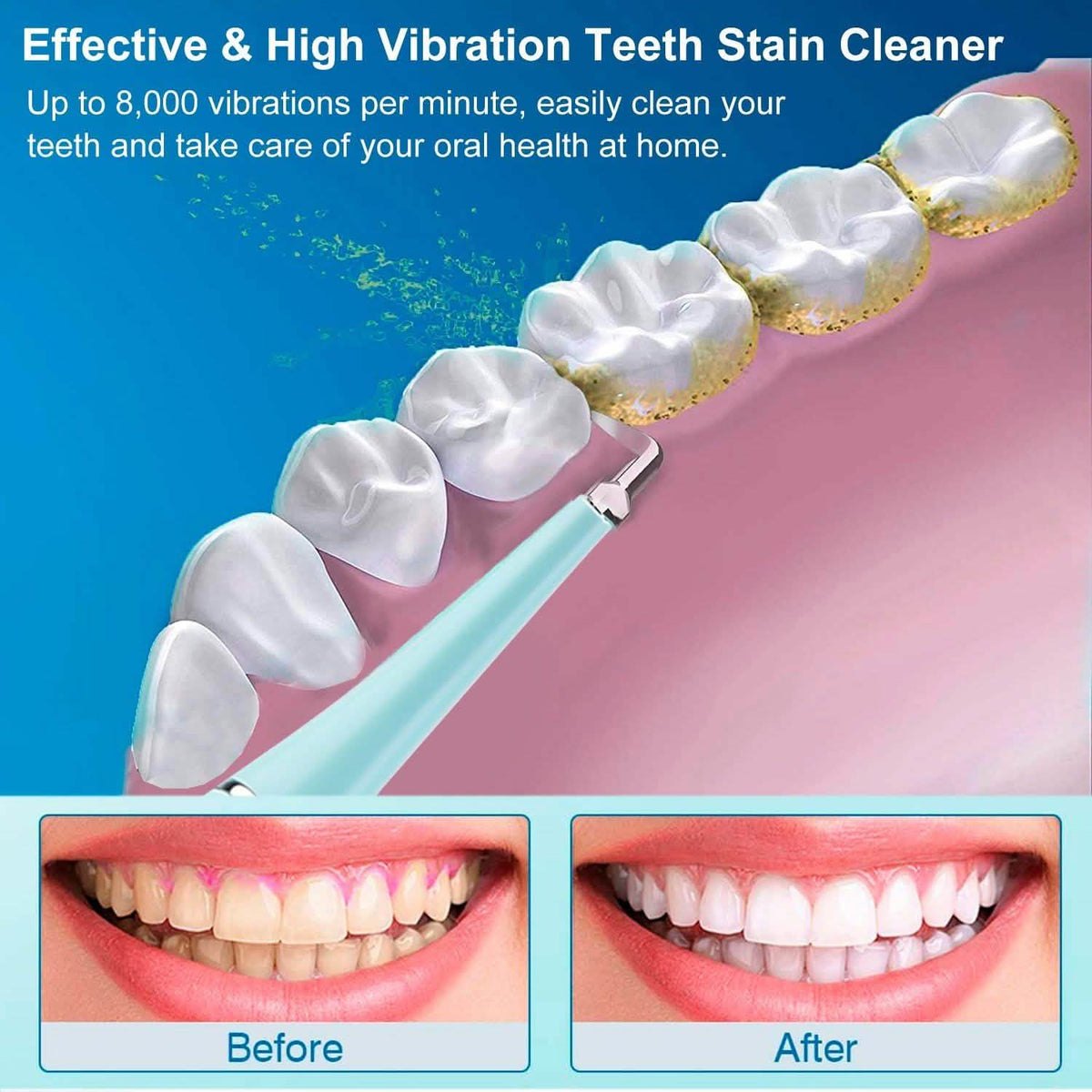 Electric Tartar Remover For Teeth Beauty & Personal Care - Tophatter Daily Deals