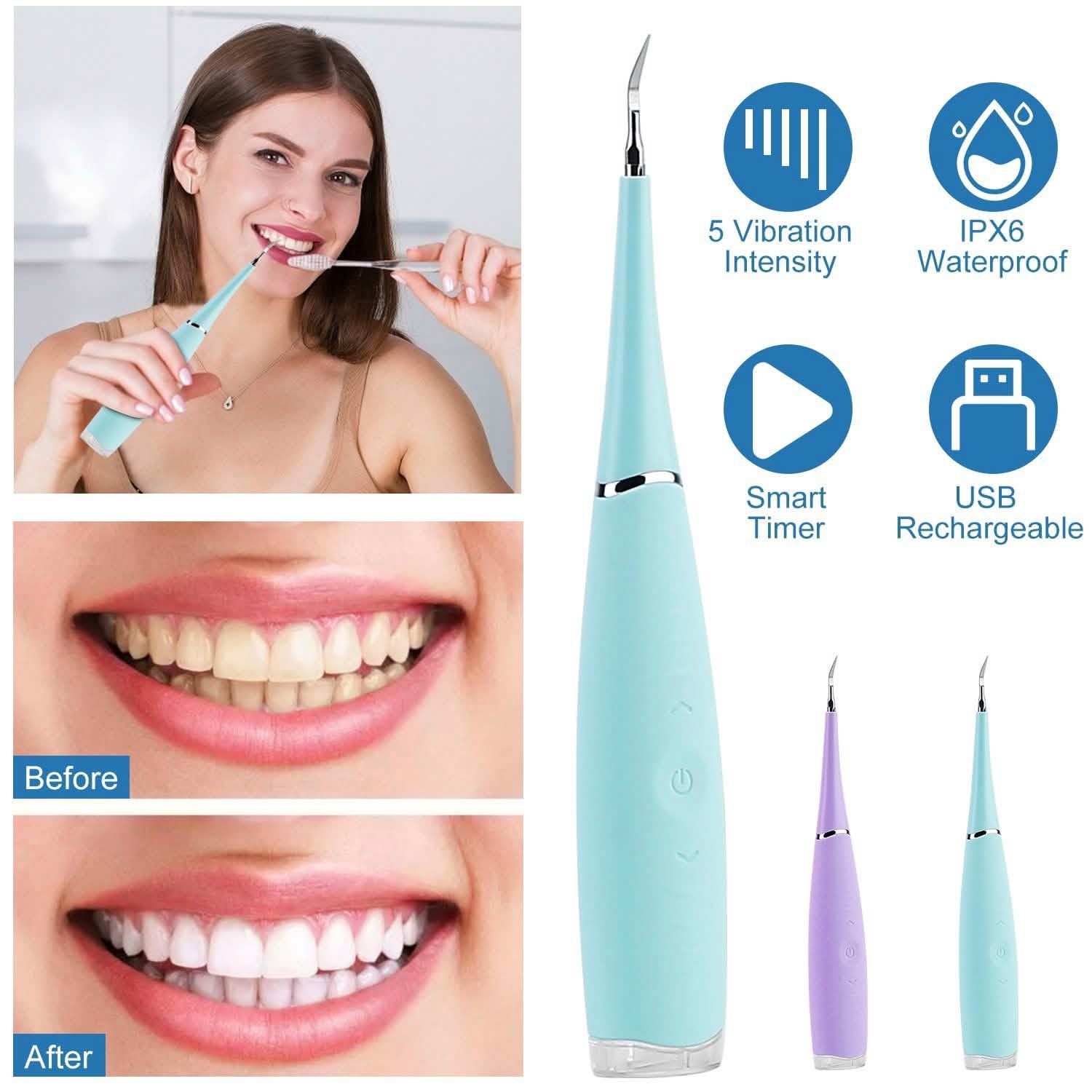 Electric Tartar Remover For Teeth Beauty & Personal Care - Tophatter Daily Deals