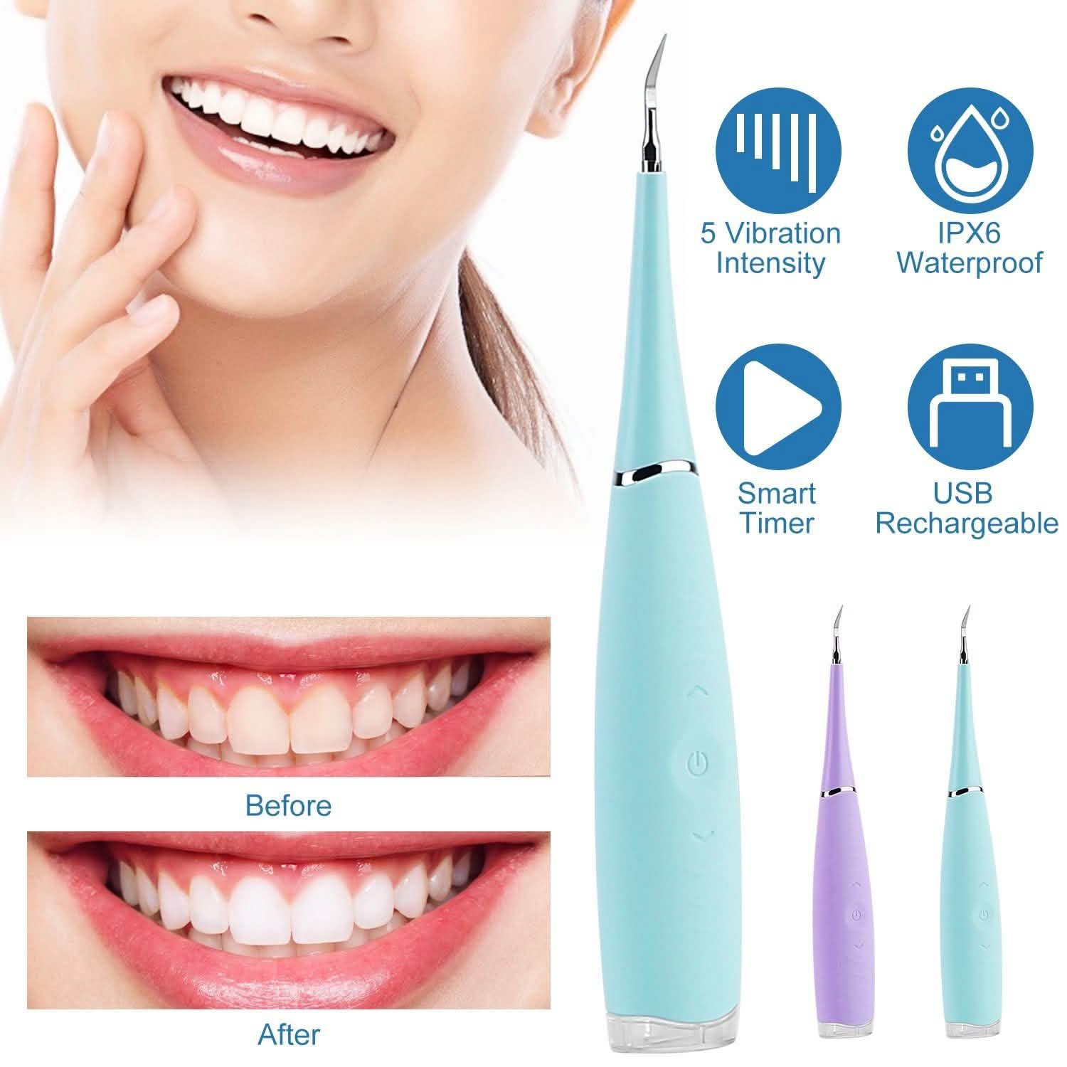 Electric Tartar Remover For Teeth Beauty & Personal Care - Tophatter Daily Deals