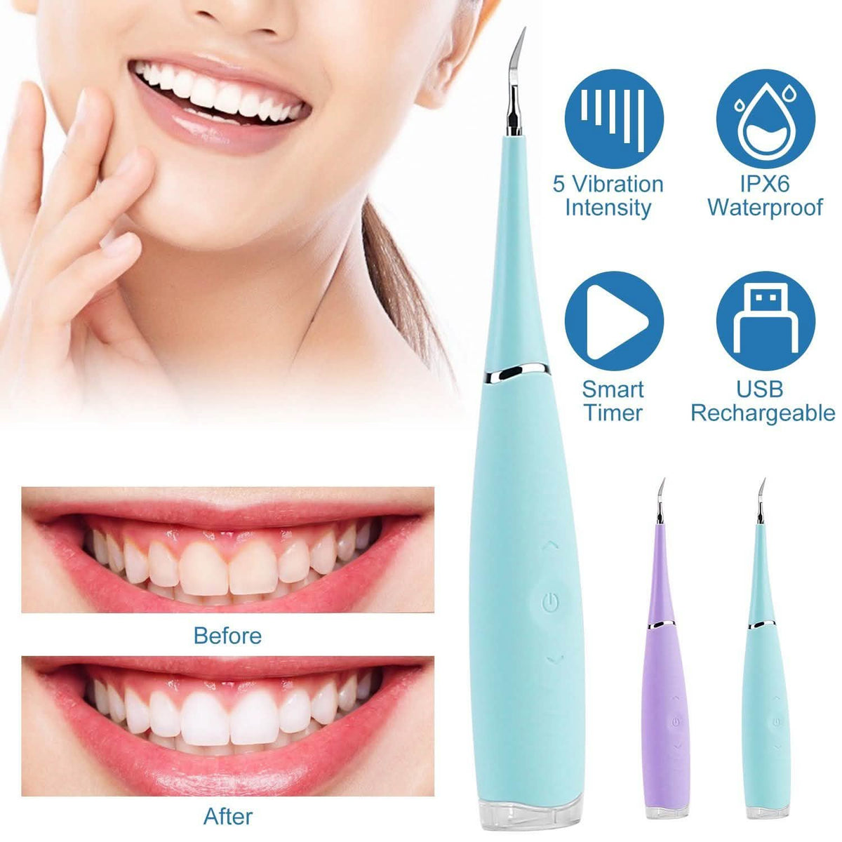 Electric Tartar Remover For Teeth Beauty & Personal Care - Tophatter Daily Deals
