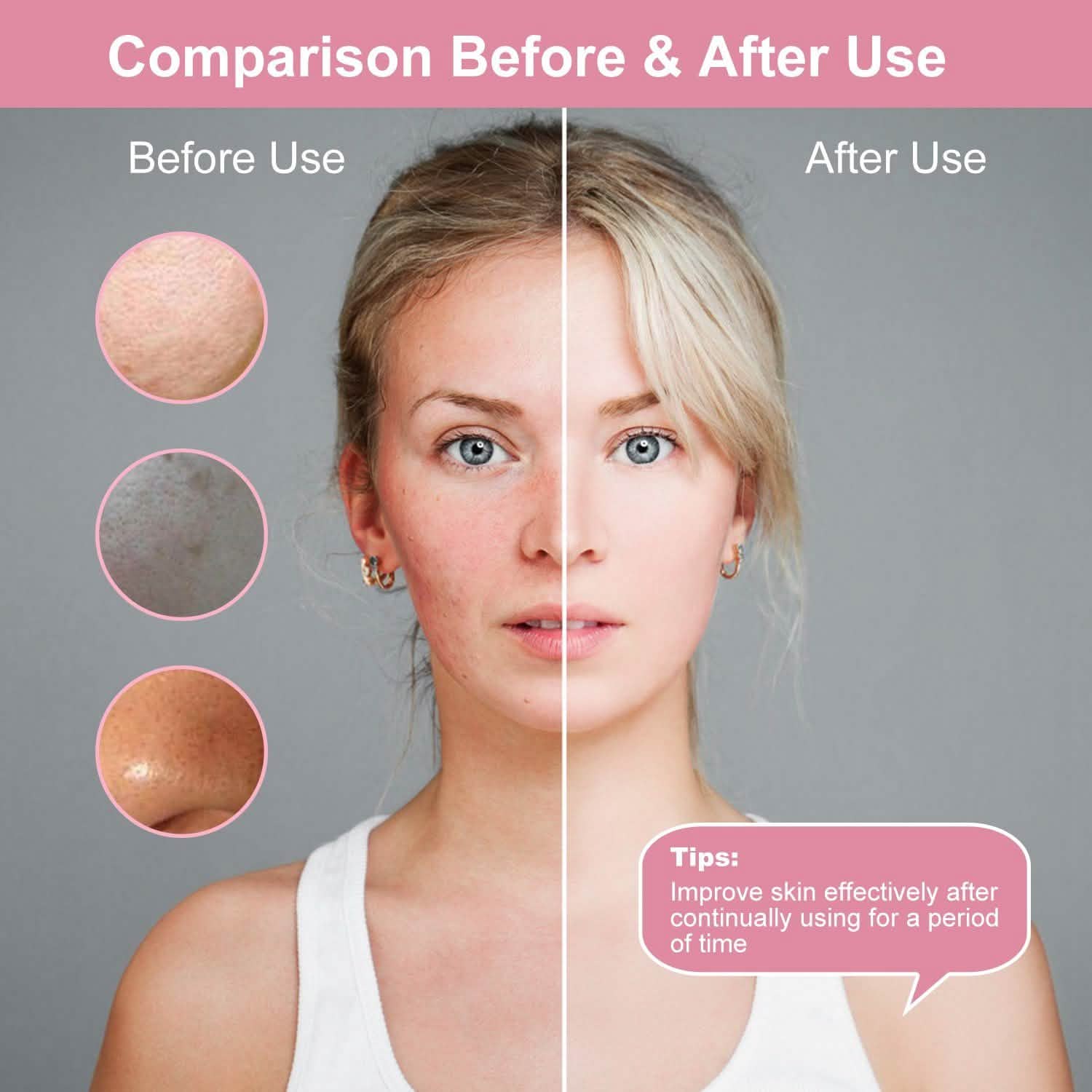 Facial Cleansing Brush IPX6 Waterproof 2 Speed Face Brush Beauty & Personal Care - Tophatter Daily Deals