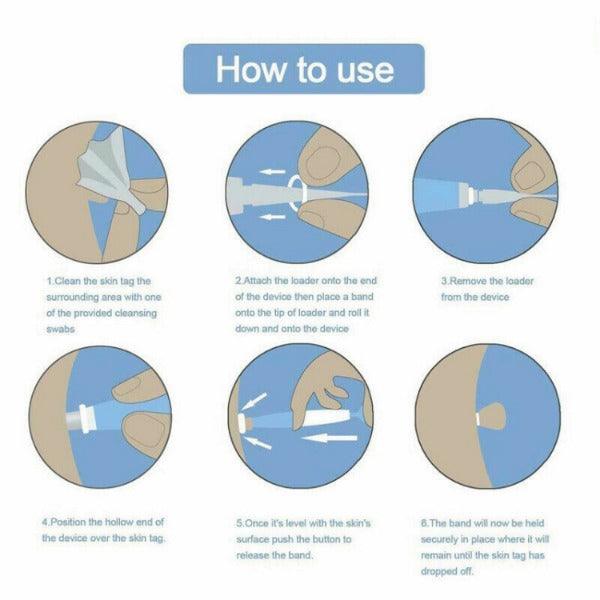 Skin Tag Removal Kit - Natural Painless Auto SKIN TAG Removal Skin tag bands Remover Device Personal Care - Tophatter Daily Deals